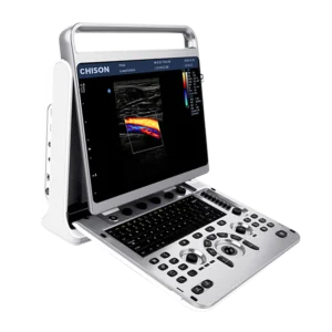 Ecógrafo Chison EBit 20
