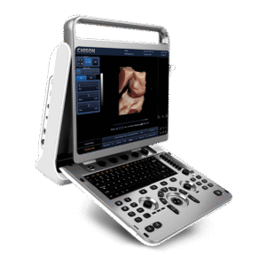 Ecógrafo EBit 30